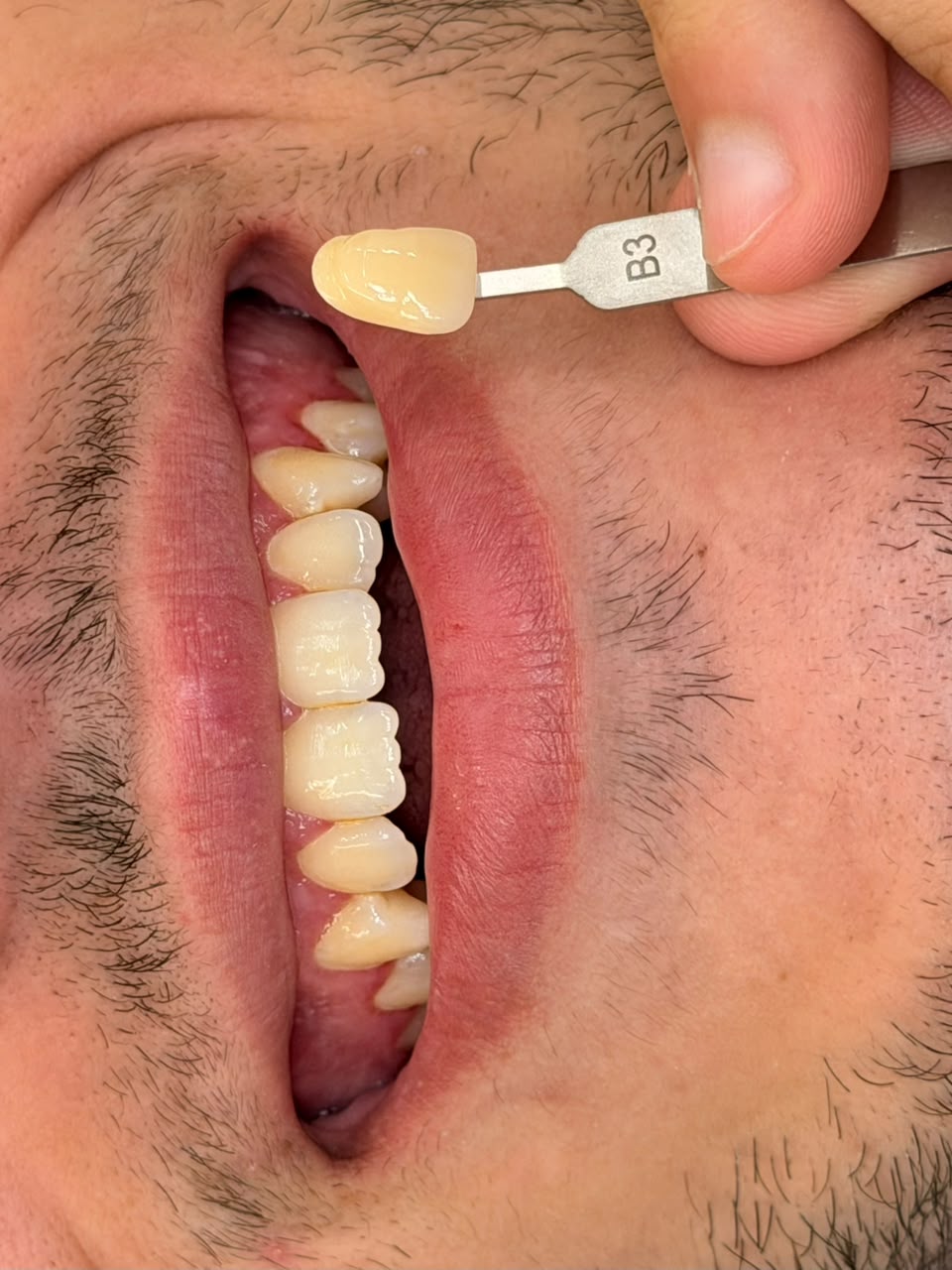 Registro clínico de atendimento odontológico 3